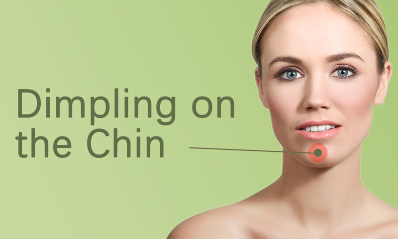 Dimpling On The Chin Treatment In Surat Elegance Clinic