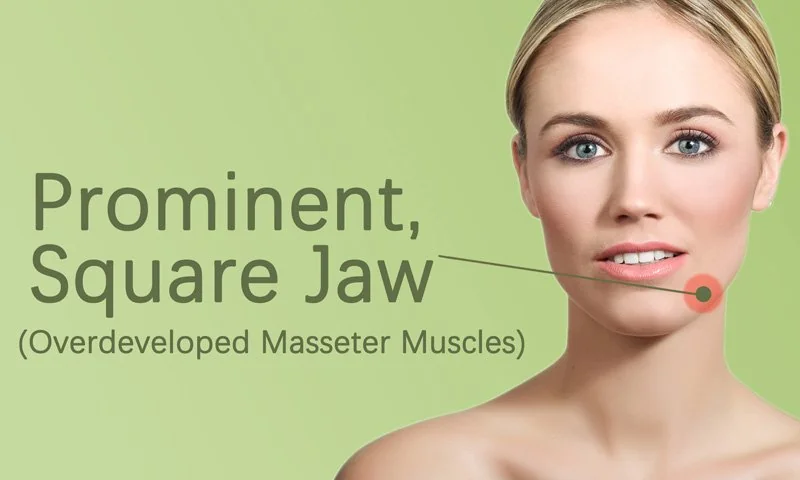 Square Jaw and Chin Treatment in Surat in Surat