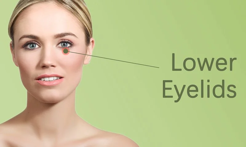 Lower Eyelid Treatment in Surat in Surat
