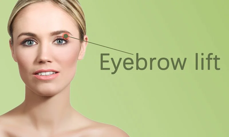 Eyebrow Lift in Surat in Surat
