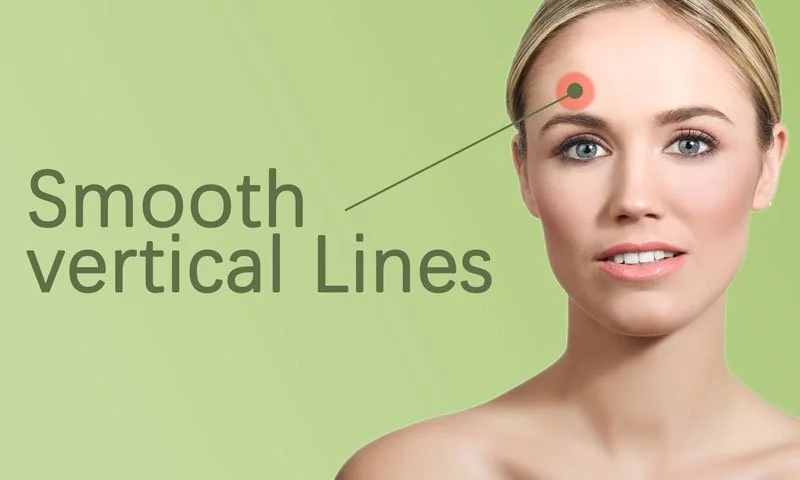 Smoothing Fine Vertical Lines with Skin Boosters in Surat in Surat